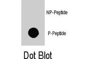 Dot blot analysis of MAP3K7IP1 (phospho S423) polyclonal antibody  on nitrocellulose membrane. (TAB1 antibody  (C-Term))