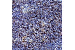 Immunohistochemistry of paraffin-embedded human tonsil using Human IgM Rabbit mAb (ABIN7267845) at dilution of 1:100 (40x lens). (IGHM antibody)