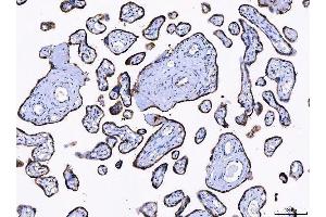 IHC analysis of LNPEP using anti-LNPEP antibody (ABIN7600279). (LNPEP antibody  (AA 17-994))