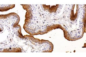 Detection of UPK2 in Rat Bladder Tissue using Polyclonal Antibody to Uroplakin 2 (UPK2) (Uroplakin 2 antibody  (AA 26-153))