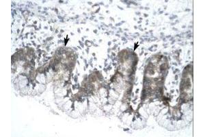 Image no. 1 for anti-Influenza Virus NS1A Binding Protein (IVNS1ABP) (N-Term) antibody (ABIN203235) (IVNS1ABP antibody  (N-Term))