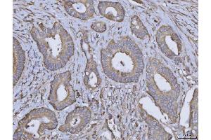 IHC analysis of ARL1 using anti-ARL1 antibody (ABIN7602848). (ARL1 antibody  (C-Term))