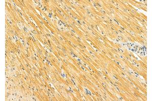 ABIN6265094 and ABIN6278291 at 1/100 staining Rat heart tissue by IHC-P. (SIRT5 antibody  (Internal Region))