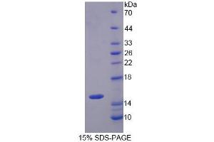 Image no. 1 for Solute Carrier Family 22 Member 4 (SLC22A4) (AA 42-141) protein (His tag) (ABIN4990223)
