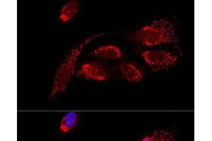 Confocal immunofluorescence analysis of U2OS cells using ATP5H Polyclonal Antibody at dilution of 1:100. (ATP5H antibody)