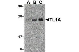 Western Blotting (WB) image for anti-Tumor Necrosis Factor (Ligand) Superfamily, Member 15 (TNFSF15) (N-Term) antibody (ABIN2476844) (TNFSF15 antibody  (N-Term))