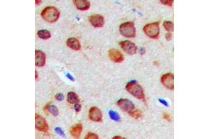 Immunohistochemical analysis of Nogo staining in human brain formalin fixed paraffin embedded tissue section. (Reticulon 4 antibody  (Center))