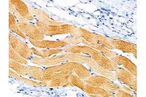 ABIN6258888 and ABIN6274835 at 1/100 staining Rat skin tissue by IHC-P. (SGCA antibody  (Internal Region))
