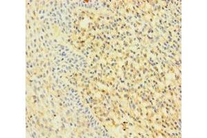Immunohistochemistry of paraffin-embedded human tonsil tissue using ABIN7167200 at dilution of 1:100 (RAC2 antibody  (AA 1-189))