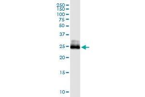 Immunoprecipitation of CITED1 transfected lysate using anti-CITED1 MaxPab rabbit polyclonal antibody and Protein A Magnetic Bead , and immunoblotted with CITED1 monoclonal antibody (M01), clone 6G8 . (CITED1 antibody  (AA 1-193))