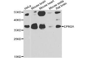 Western blot analysis of extracts of various cell lines, using EPM2A antibody. (EPM2A antibody)