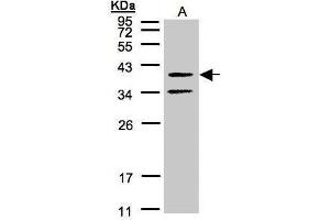 WB Image Sample(30 μg of whole cell lysate) A:A431, 12% SDS PAGE antibody diluted at 1:500 (GALR2 antibody  (C-Term))