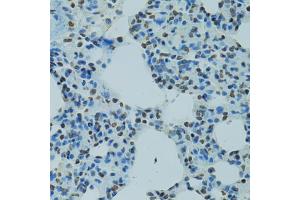 Immunohistochemistry of paraffin-embedded rat lung using AHR antibody (ABIN5970677) at dilution of 1/100 (40x lens). (Aryl Hydrocarbon Receptor antibody)