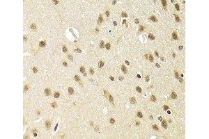 Immunohistochemistry of paraffin-embedded Rat brain using HEXIM1 Polyclonal Antibody at dilution of 1:100 (40x lens). (HEXIM1 antibody)