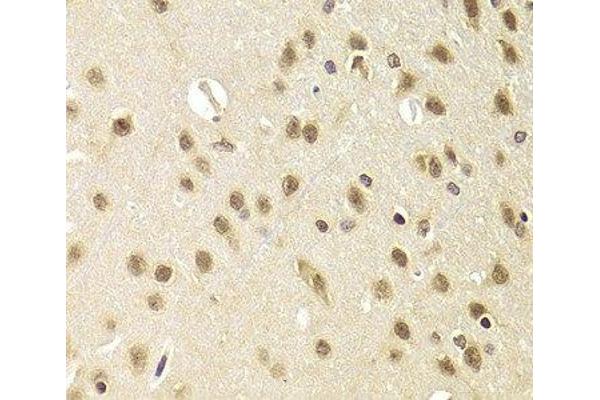 HEXIM1 antibody
