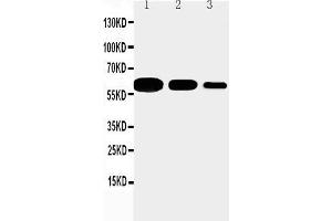 Anti-CD40 antibody, Western blotting Lane 1: Recombinant Mouse CD 40 Protein 10ng Lane 2: Recombinant Mouse CD 40 Protein 5ng Lane 3: Recombinant Mouse CD 40 Protein 2.