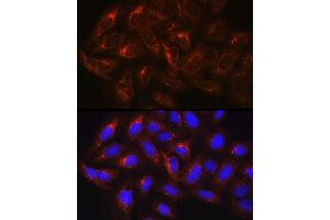 Immunofluorescence analysis of U-2 OS cells using HGS Rabbit pAb (ABIN6131749, ABIN6141748, ABIN6141749 and ABIN6218898) at dilution of 100 (40x lens). (HGS antibody  (AA 548-777))