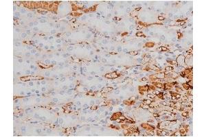 ABIN6255614 and ABIN6267361 at 1/200 staining Rat kidney tissue sections by IHC-P. (tau antibody  (pThr181, pThr498))
