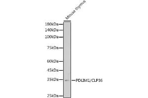 Western blot analysis of extracts of Mouse thymus, using PDLIM1/CLP36 antibody (ABIN7269195) at 1:1000 dilution. (PDLIM1 antibody)