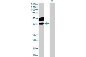 Western Blot analysis of CDC123 expression in transfected 293T cell line by CDC123 MaxPab polyclonal antibody. (CDC123 antibody  (AA 1-336))