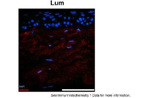 Sample Type: mouse cornea (cystinosin Ko)Blue: DAPIRed: LumPrimary Dilution: 1:250Image Submitted By: Geraint ParfittGavin Herbert Eye Institute . (LUM antibody  (N-Term))