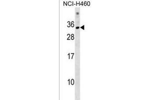 KRBOX1 Antibody (C-term) (ABIN1537656 and ABIN2838166) western blot analysis in NCI- cell line lysates (35 μg/lane). (KRBOX1 antibody  (C-Term))