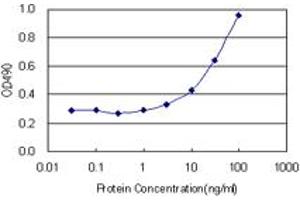 BST1 (Human) Matched Antibody Pair