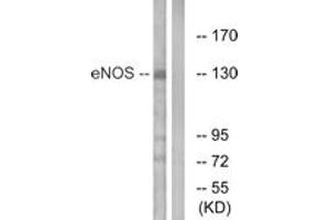 Western blot analysis of extracts from Jurkat cells, using eNOS (Ab-615) Antibody. (ENOS antibody  (AA 581-630))
