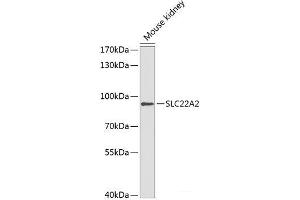 Western blot analysis of extracts of Mouse kidney using SLC22A2 Polyclonal Antibody at dilution of 1:1000.
