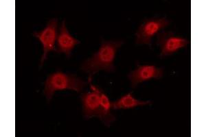 ABIN6268929 staining K562 by IF/ICC. (TRAF2 antibody  (C-Term))