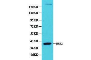 Western Blotting (WB) image for anti-Sirtuin 2 (SIRT2) antibody (ABIN1874785) (SIRT2 antibody)