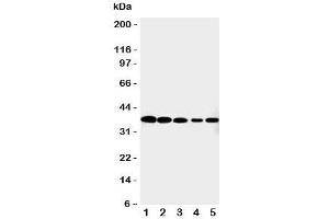 Western blot testing of Cdk7 antibody and Lane 1:  HeLa;  2: MCF-7;  3: A549;  4: COLO320;  5: Jurkat cell lysate. (CDK7 antibody  (C-Term))