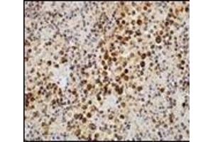 Immunohistochemistry (IHC) image for anti-PDZ and LIM Domain 7 (Enigma) (PDLIM7) (C-Term) antibody (ABIN870474) (PDLIM7 antibody  (C-Term))