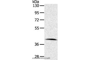 Western blot analysis of Human lymphoma tissue, using CDK10 Polyclonal Antibody at dilution of 1:100 (CDK10 antibody)