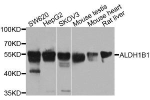 Western blot analysis of extracts of various cell lines, using ALDH1B1 antibody. (ALDH1B1 antibody  (AA 278-517))
