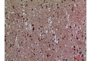 Immunohistochemistry (IHC) analysis of paraffin-embedded Human Brain, antibody was diluted at 1:100. (CDK4 antibody  (N-Term))