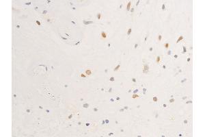 Immunohistochemistry (IHC) image for anti-Epidermal Growth Factor Receptor (EGFR) (pSer695) antibody (ABIN6255471)