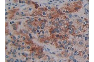 Immunohistochemistry (IHC) image for anti-Neuropeptide Y (NPY) (AA 30-97) antibody (ABIN7432820)