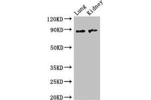 Western Blot Positive WB detected in: Mouse lung tissue, Mouse kidney tissue All lanes: NAALADL2 antibody at 3. (NAALADL2 antibody  (AA 143-795))