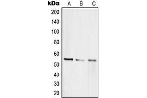 Western blot analysis of RAP1A expression in HEK293T (A), HeLa (B), PC12 (C) whole cell lysates. (RAP1A antibody  (Center))