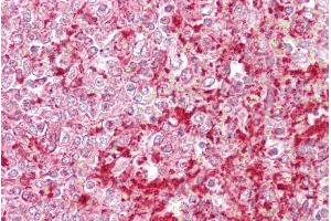 Immunohistochemistry with Spleen tissue at an antibody concentration of 5µg/ml using anti-ETV5 antibody (ARP31658_P050) (ETV5 antibody  (N-Term))