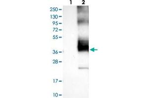 Western blot analysis of Lane 1: Negative control (vector only transfected HEK293T lysate), Lane 2: Over-expression Lysate (Co-expressed with a C-terminal myc-DDK tag (~3. (KCNK1 antibody)
