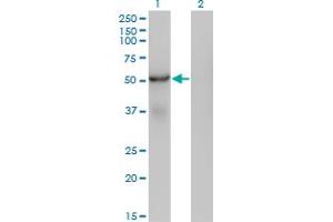 Western Blot analysis of SNX25 expression in transfected 293T cell line by SNX25 monoclonal antibody (M01), clone 3A8. (SNX25 antibody  (AA 1-483))