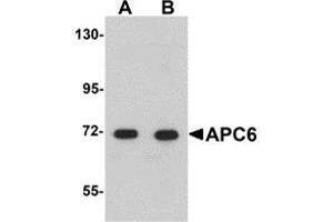 Western blot analysis of APC6 in human liver tissue lysate with AP30062PU-N APC6 antibody at (A) 1 and (B) 2 μg/ml. (CDC16 antibody  (N-Term))