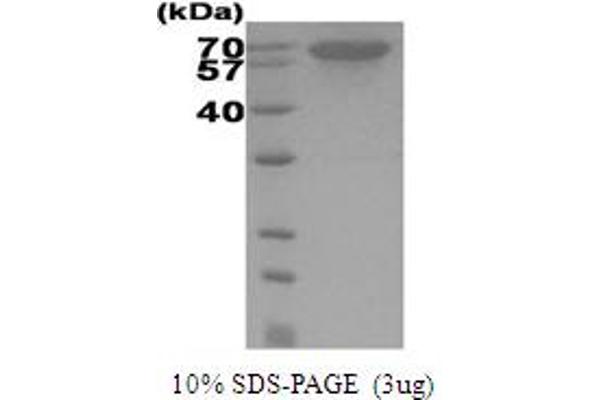 HSP70 Protein (AA 1-641) (His tag)