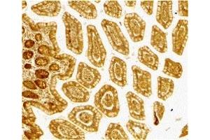 Immunohistochemistry (IHC) image for anti-CD209 (CD209) (Extracellular Domain) antibody (ABIN1030833) (DC-SIGN/CD209 antibody  (Extracellular Domain))