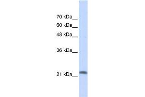 WB Suggested Anti-RASL10A Antibody Titration: 0. (RASL10A antibody  (N-Term))