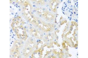 Immunohistochemistry of paraffin-embedded Rat kidney using TDGF1 Polyclonal Antibody at dilution of 1:100 (40x lens). (TDGF1 antibody)