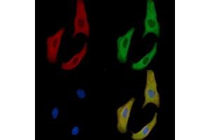 EPHA7 Mouse Monoclonal Antibody staining Hela cells by IF/ICC.