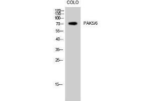 Western Blotting (WB) image for anti-PAK5/6 (Ser1197) antibody (ABIN3176756) (PAK5/6 (Ser1197) antibody)